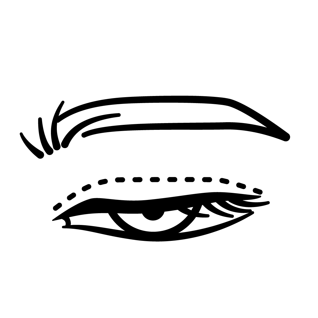 Cirurgia das pálpebras