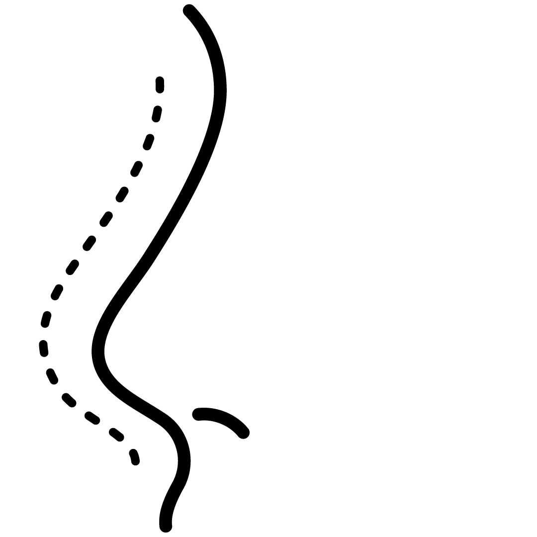 Rinoplastia