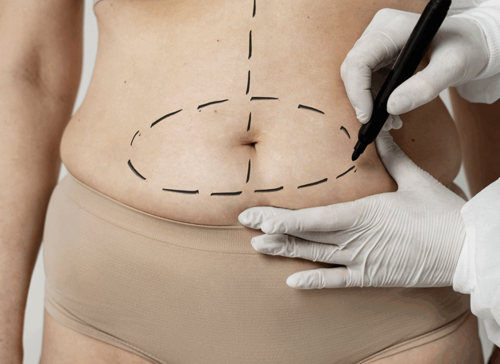 Qual o momento certo para fazer uma cirurgia plástica?