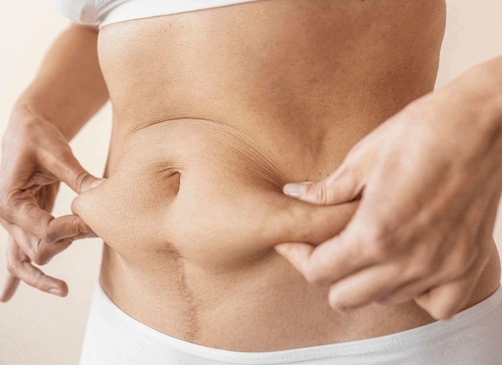 Com quanto tempo do parto posso fazer uma cirurgia plástica?